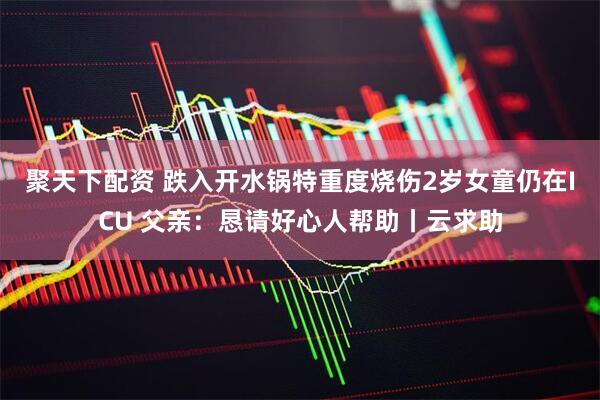 聚天下配资 跌入开水锅特重度烧伤2岁女童仍在ICU 父亲：恳请好心人帮助丨云求助